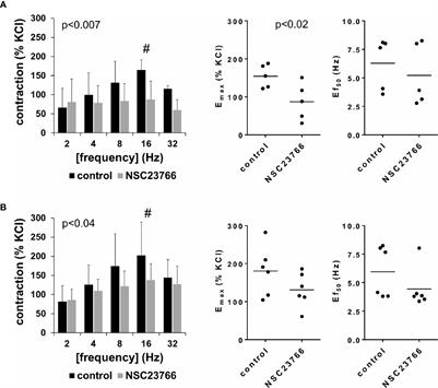 Inhibition of Female and Male Human Detrusor Smooth Muscle Contraction by the Rac Inhibitors EHT1864 and NSC23766